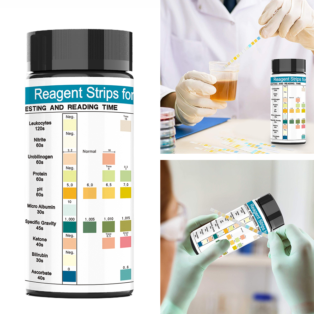 Urinalysis Reagent Strip - 100 Strips Urine Test Strip 10