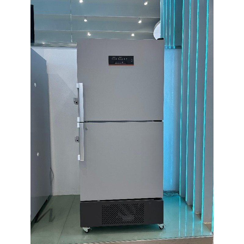 Vertical deep freezer - 25 deg - Medical Lab Degree review and price